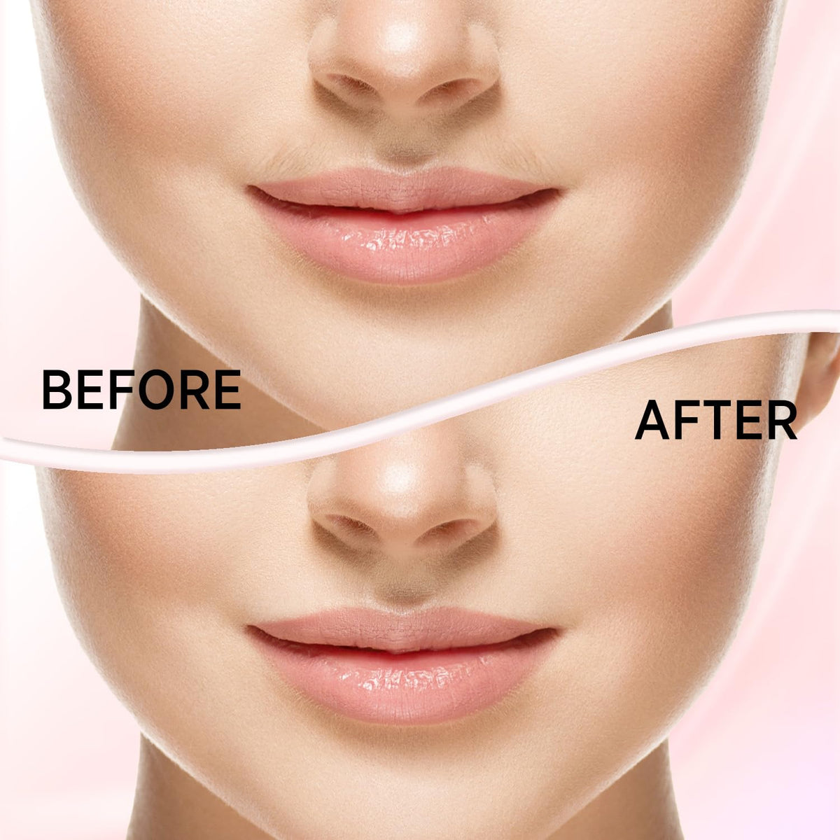 Facial Hair Removal for Women E36820